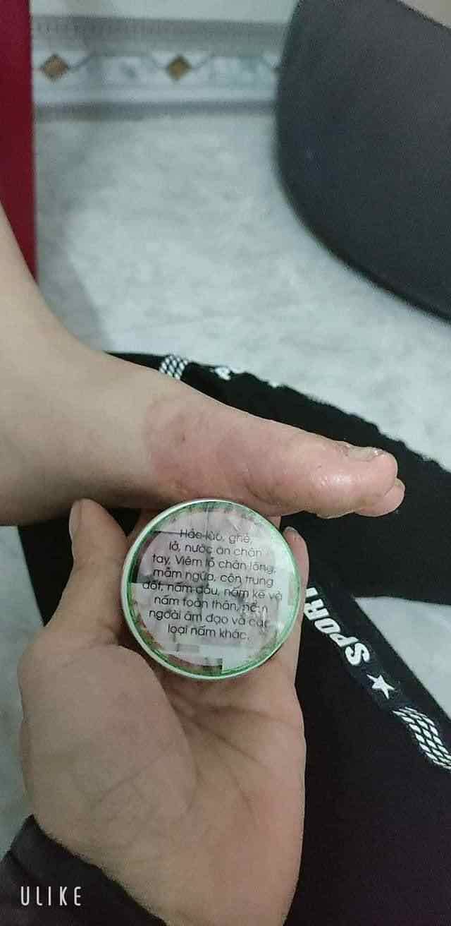VIÊM DA TRẦN KIM HUYỀN