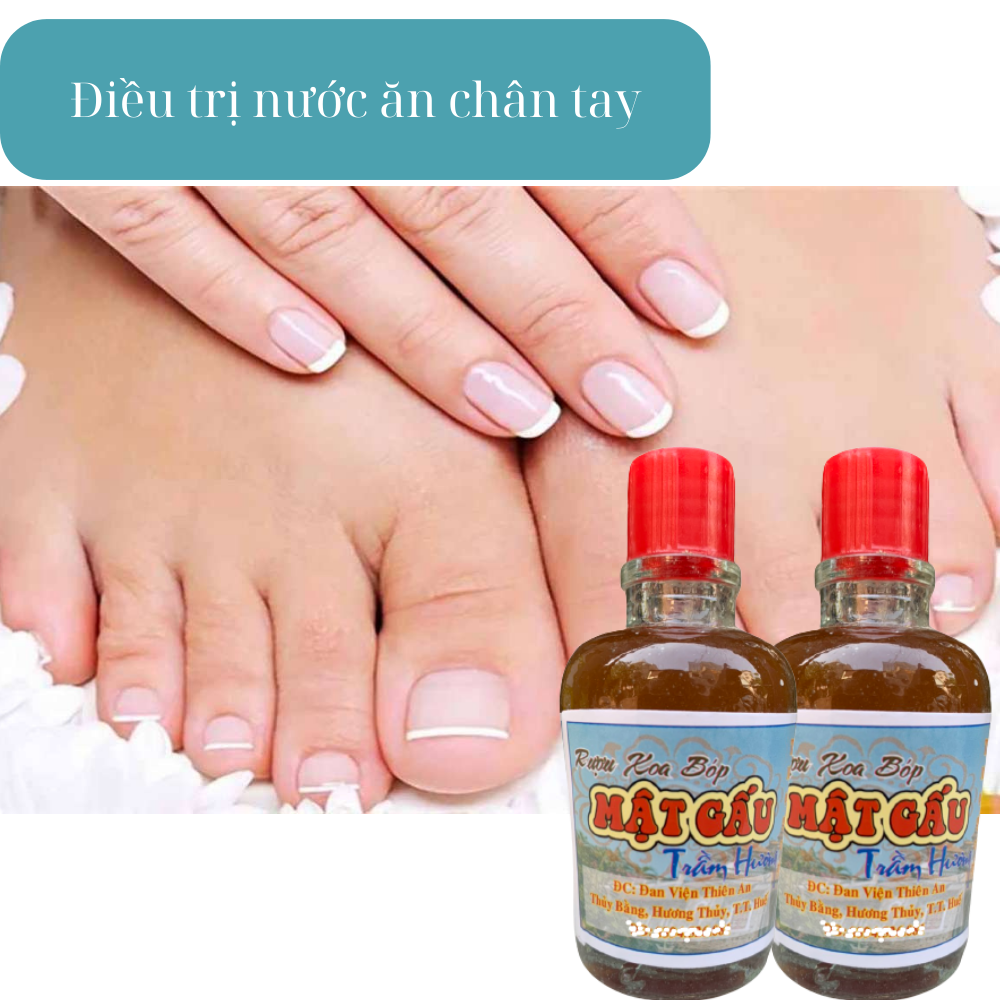 Dầu Xoa Bóp Cây Mật Gấu Thiên An