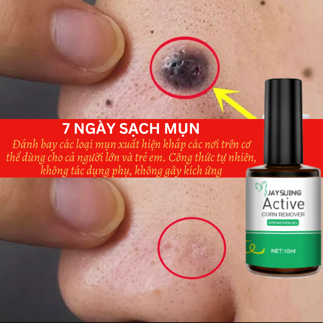 [Loại Xịn] Jaysuing Serum tẩy nốt ruồi xóa mụn ruồi trên mặt, tàn nhang, mụn cóc, mụn thịt , mụn cơm, mắt cá tại nhà an toàn hiệu quả 100%