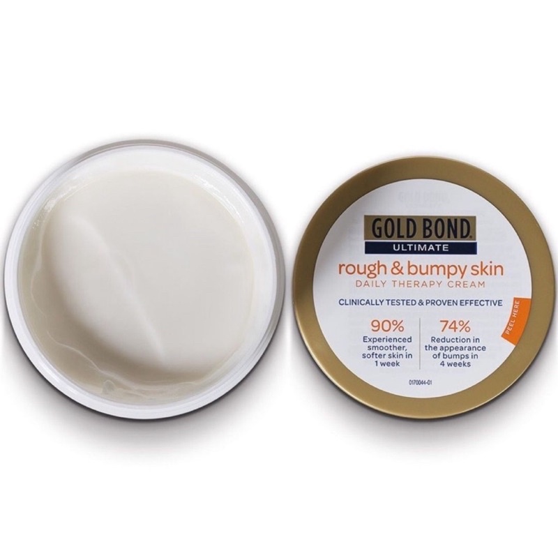 [Vitaminbear] Kem dưỡng body gold bond rough and bumpy skin