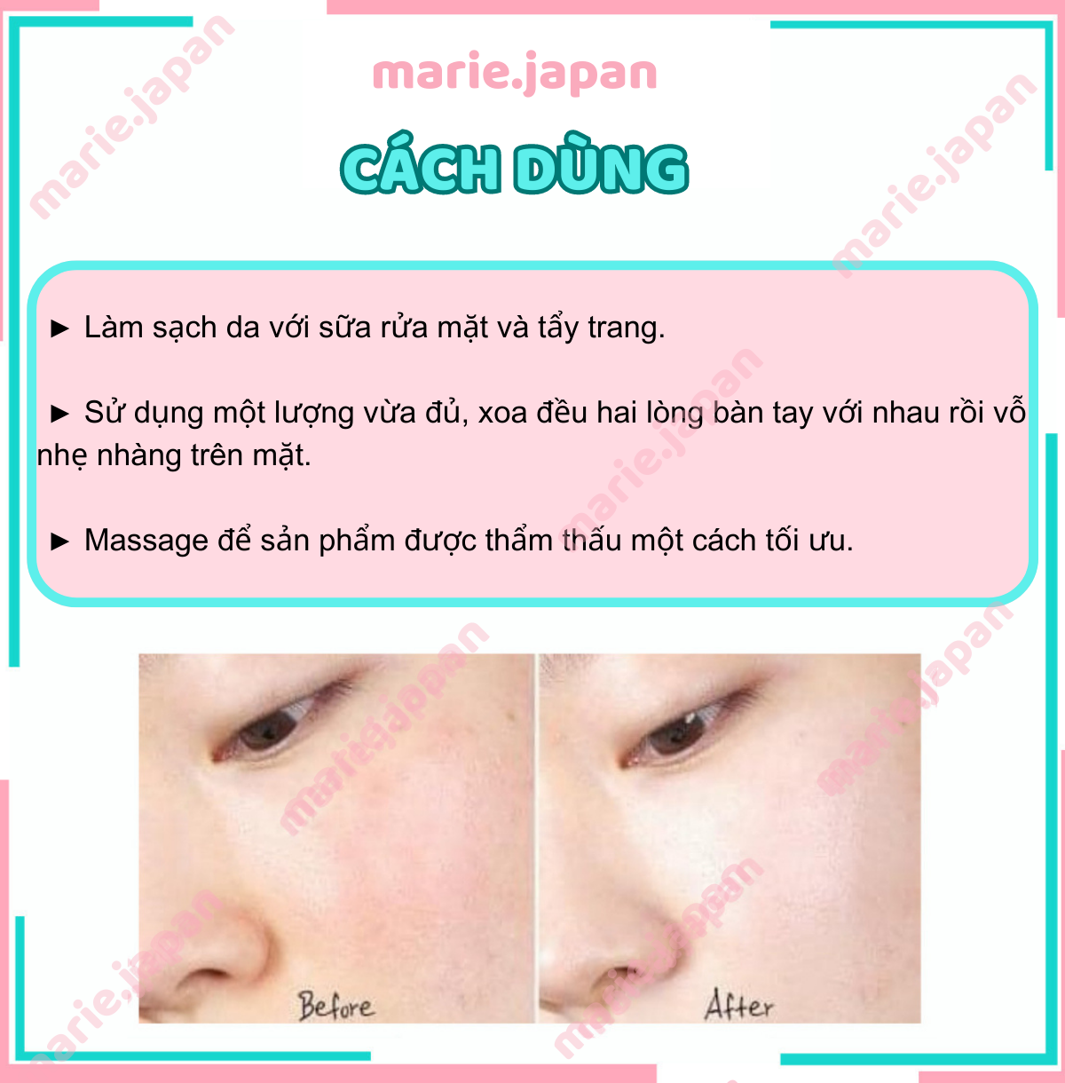Serum Hồi Phục Da GoodnDoc Hydra B5 Lọ 30ml