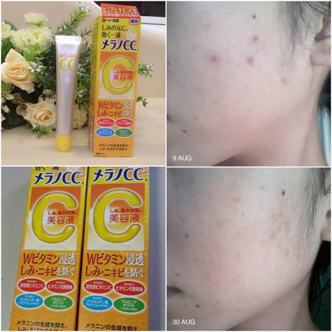 [HCM]Serum Melano Cc 20ml chính hãng Nhật Bản