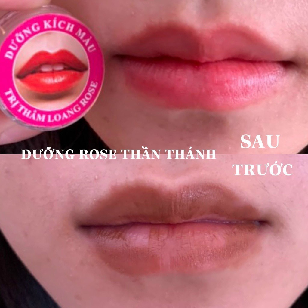Dưỡng THÂM LOANG ROSE 10g