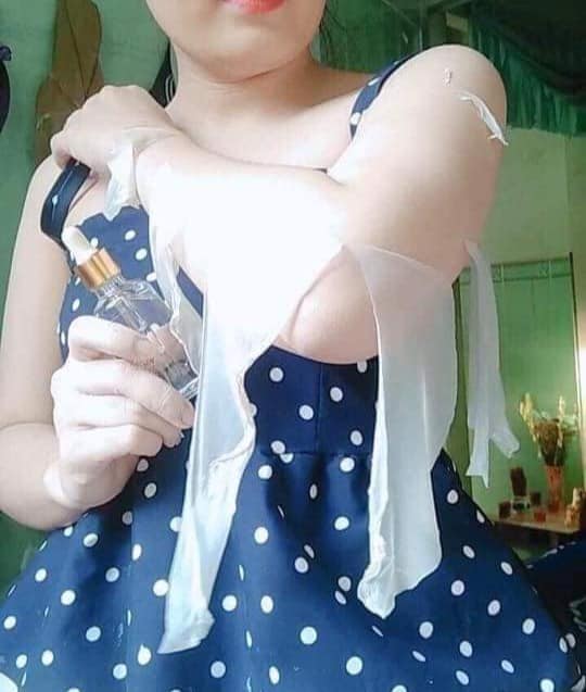 Nước lột NN thay da sinh học 50ml