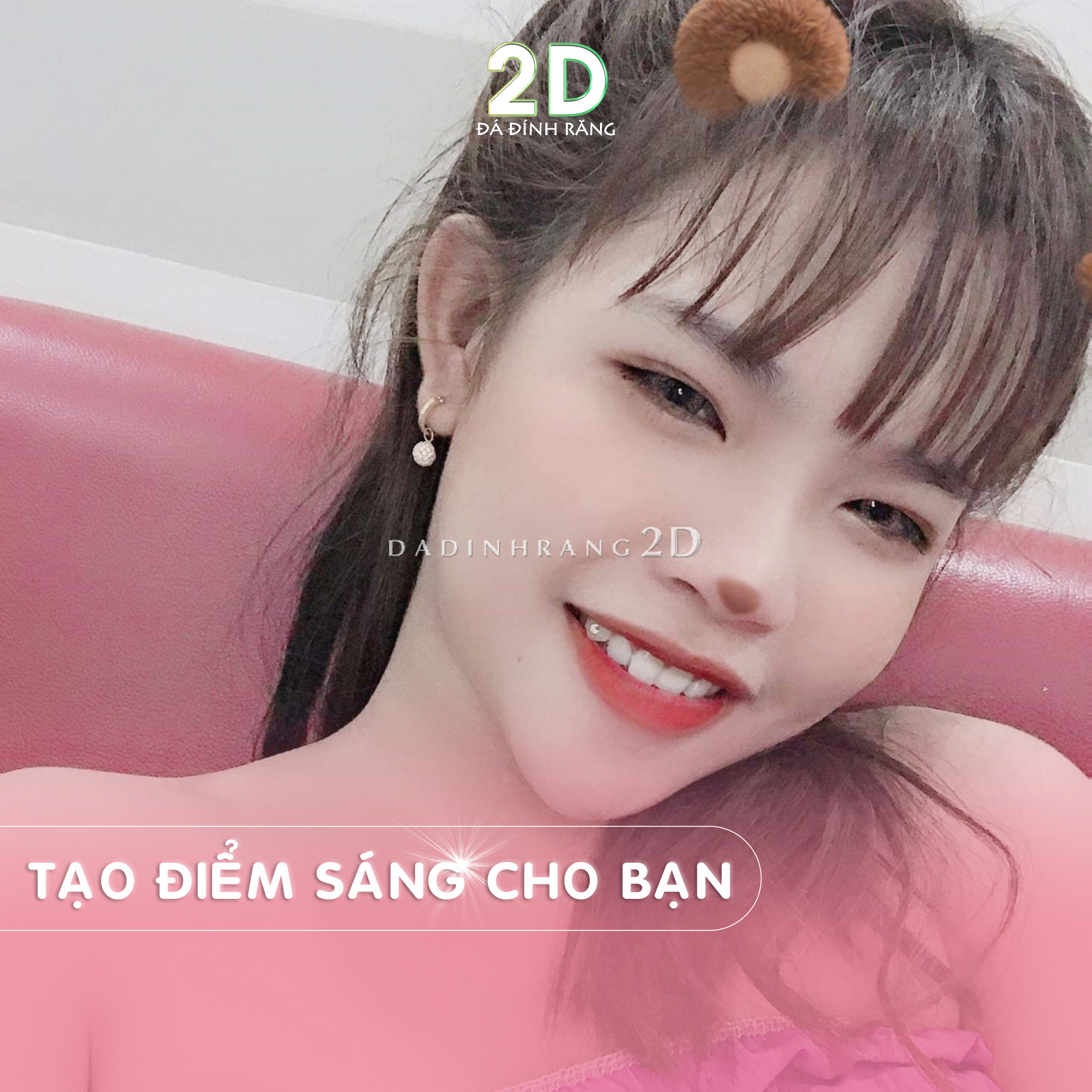 Đá Đính Răng Tại Nhà Đủ Size + Tặng Keo Dán
