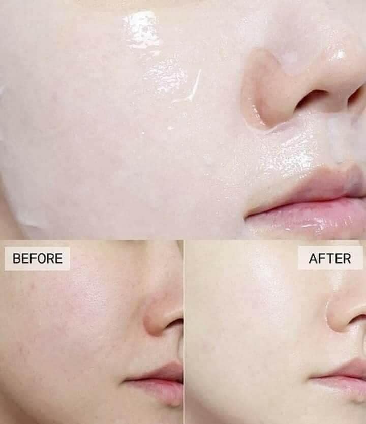 Mặt Nạ Mediheal Essential Mask
