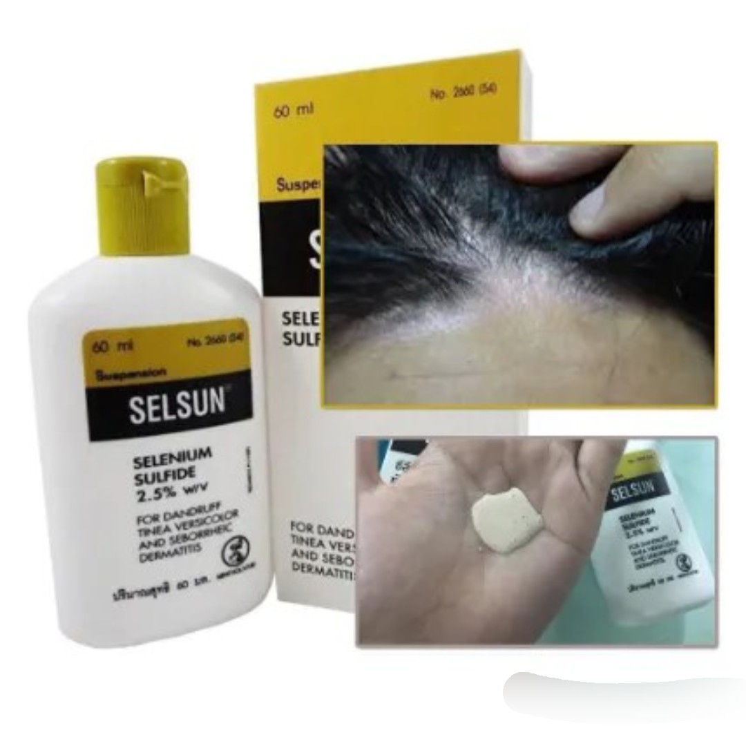 Dầu Gội SELSUN SELENIUM SULFIDE 2,5% Thái Lan 120ml