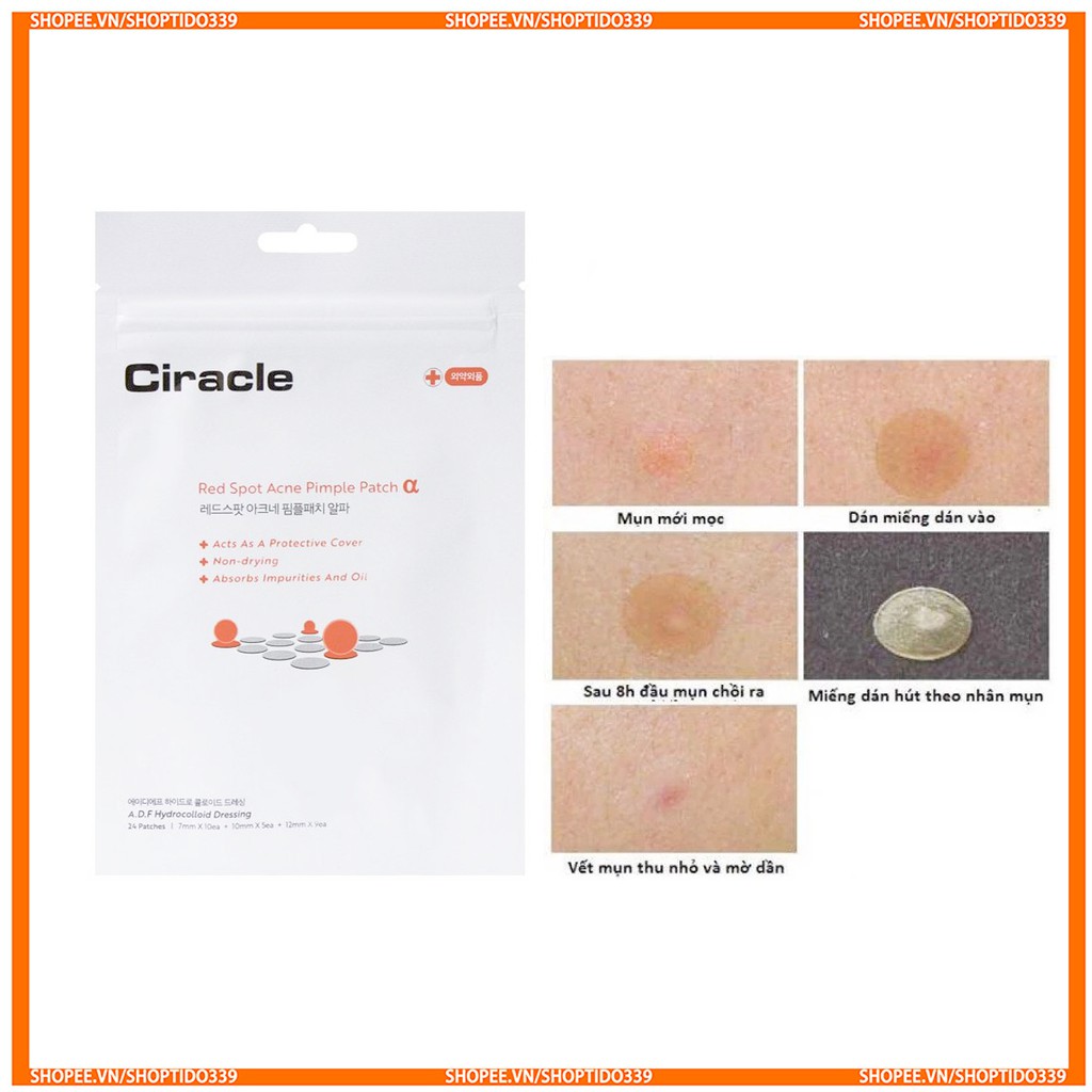 Miếng Dán Mụn Ciracle Red Spot Acne Pimple Patch 24 Miếng