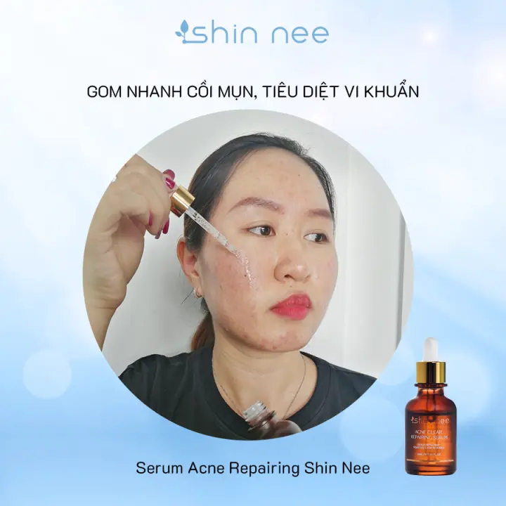 acne clear repairing serum