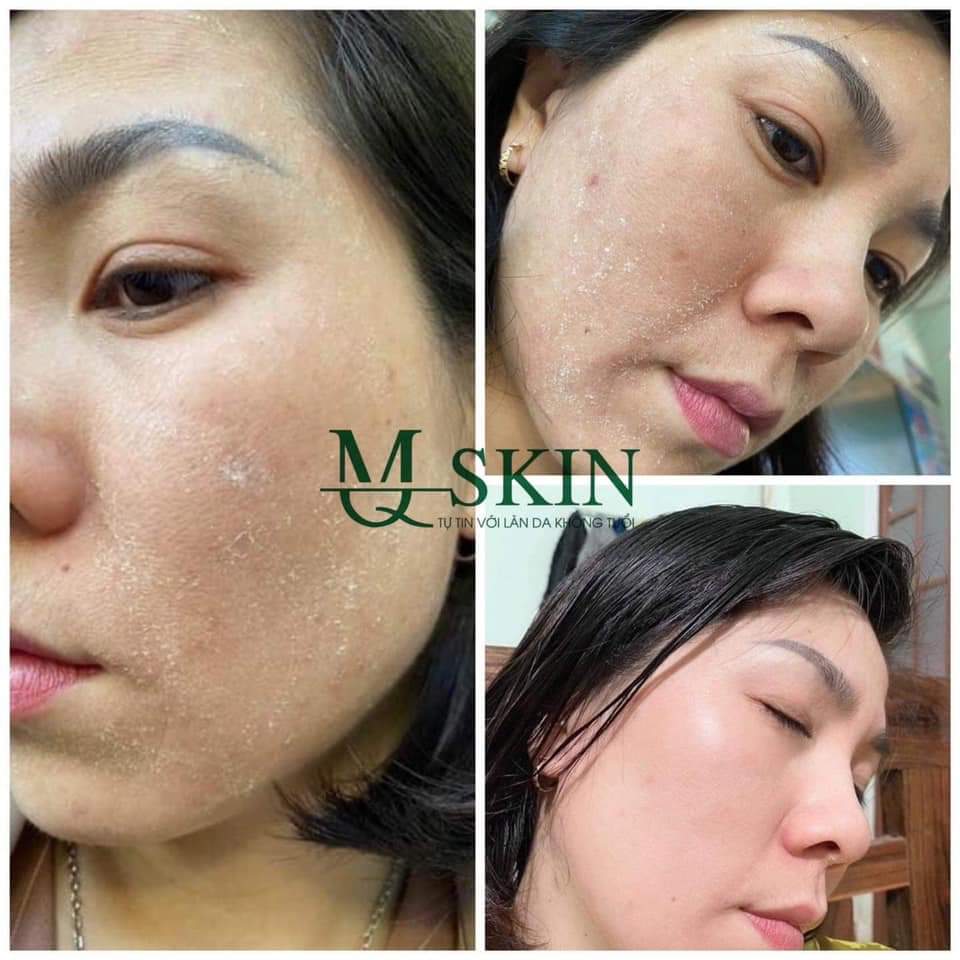 [HCM]Thay da Nhân Sâm MQSKIN