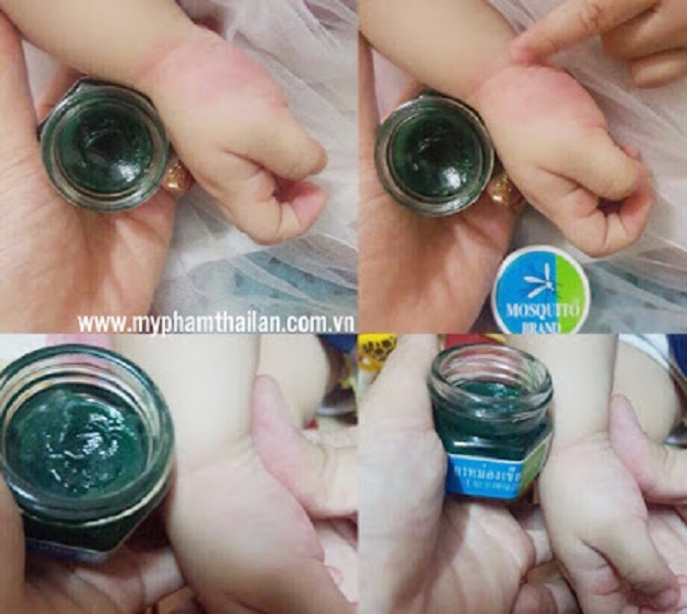 Dầu Thoa  Muỗi Đốt, Côn Trùng Cắn Cho Bé - Dầu Chống Muỗi Đốt Cho Bé