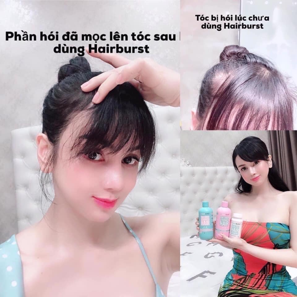 Set Gội Xả Hairburst Kích Thích Mọc Tóc 350ml x 2