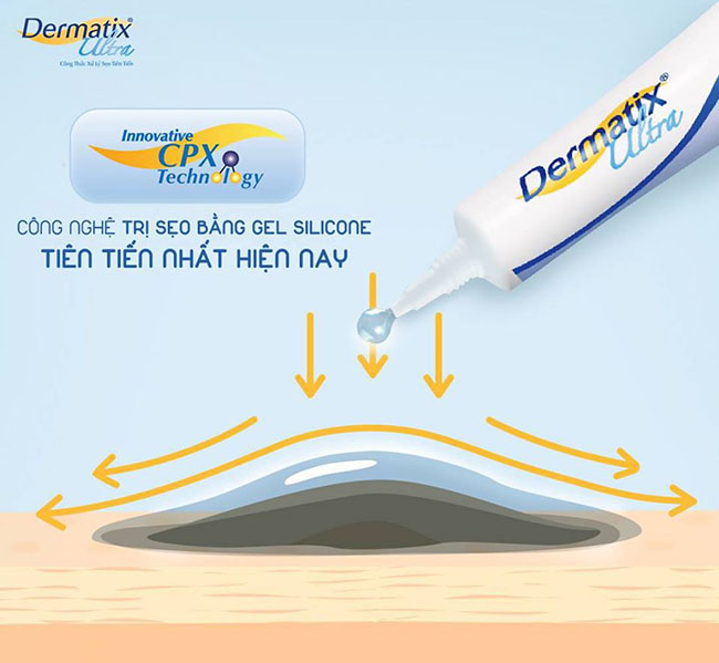 Dermatix Ultra kem làm mờ sẹo lồi, lõm 7g
