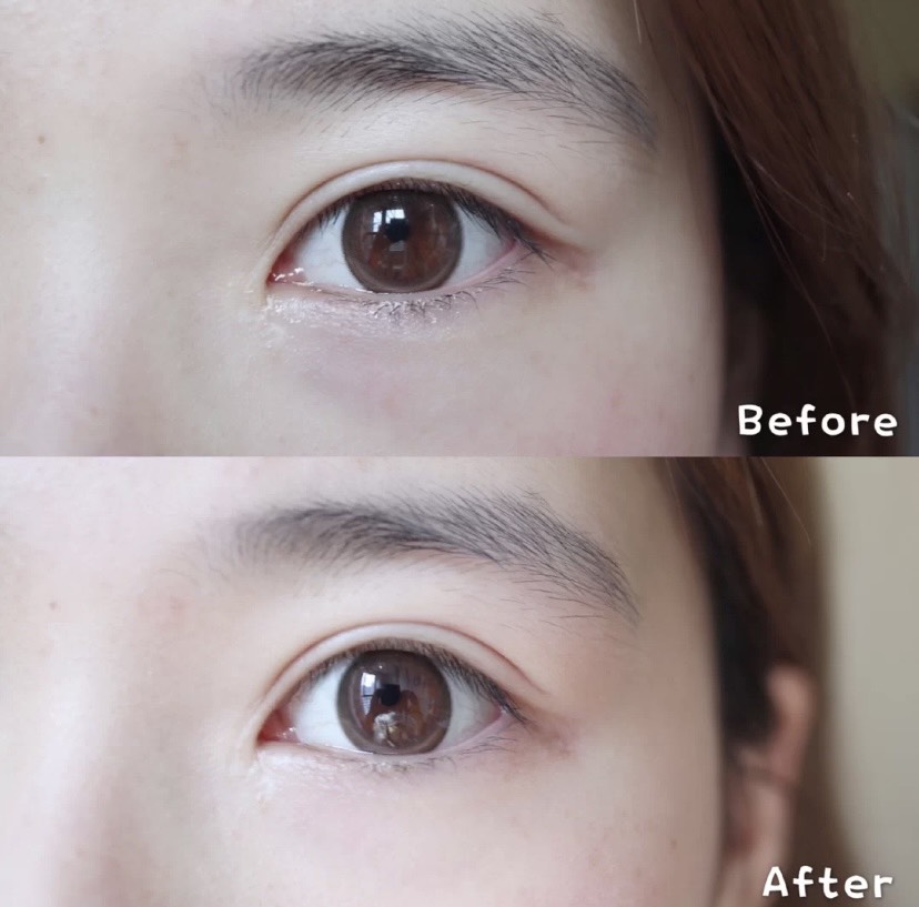 Kem dưỡng mắt EL Advanced Night Repair Concentrate Matrix 5ml