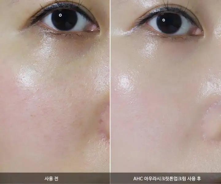 ⭐Kem dưỡng da trắng hồng căng bóng AHC Aura Secret Tone Up Cream 10ml: Mua  bán trực tuyến Dưỡng da & Serum với giá rẻ | Lazada.vn