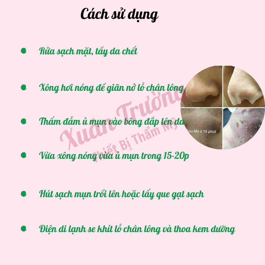 Ủ mụn đầu đen, mụn cám, Ủ mụn Youngerc chai 30ml