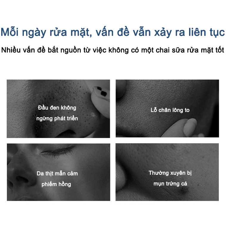 【💯Hàng thật】Sữa rửa mặt axit amin YIMIAOSI 500g