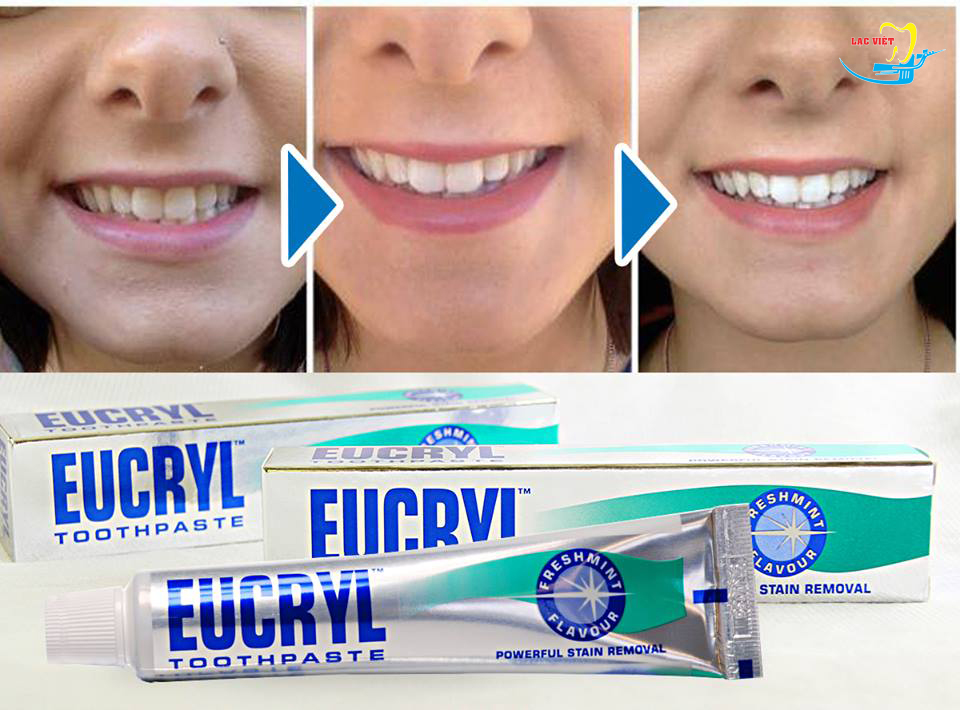 Kem đánh trắng răng Eucryl Anh