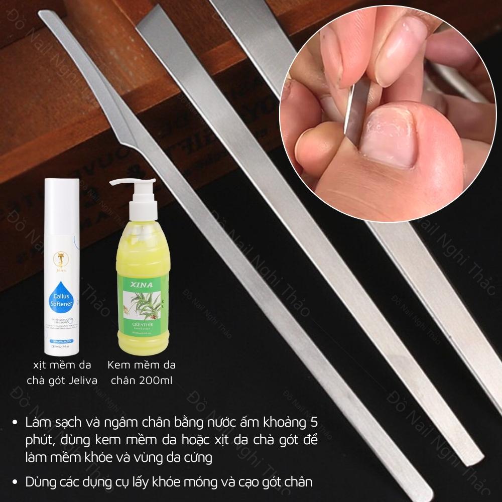 Bộ dụng cụ lấy khóe móng chân
