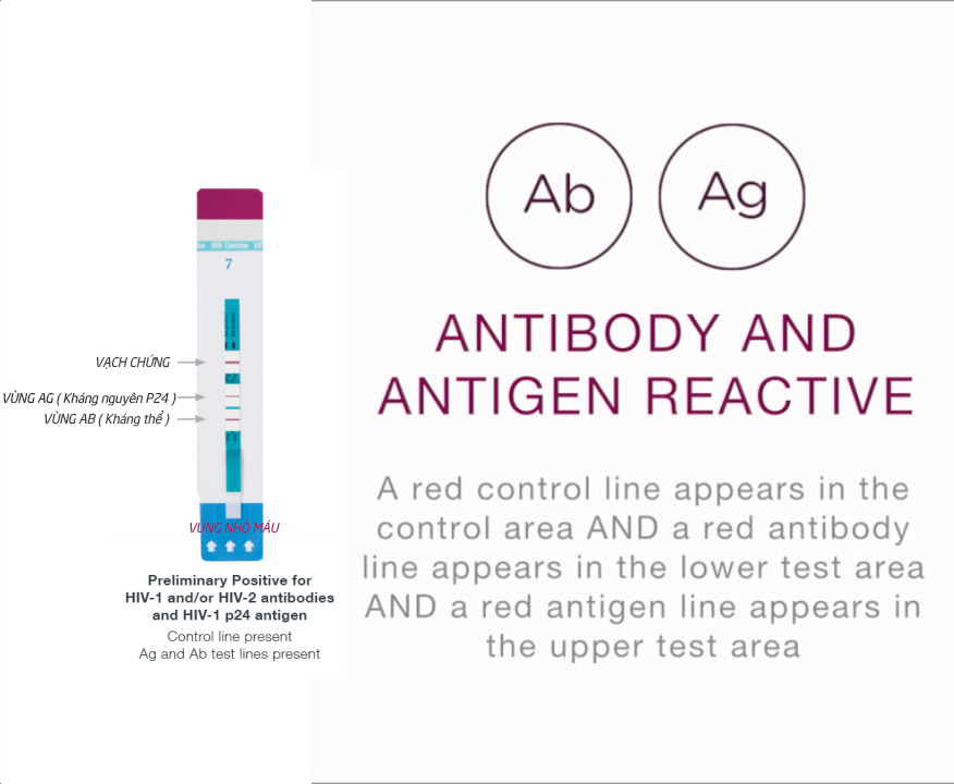 Bộ test xét nghiệm nhanh HIV Combo Alere 1/2 ( Ag/Ab) thế hệ 4, Thương hiệu Abbott, Giúp phát hiện HIV sau 14 ngày có nguy cơ