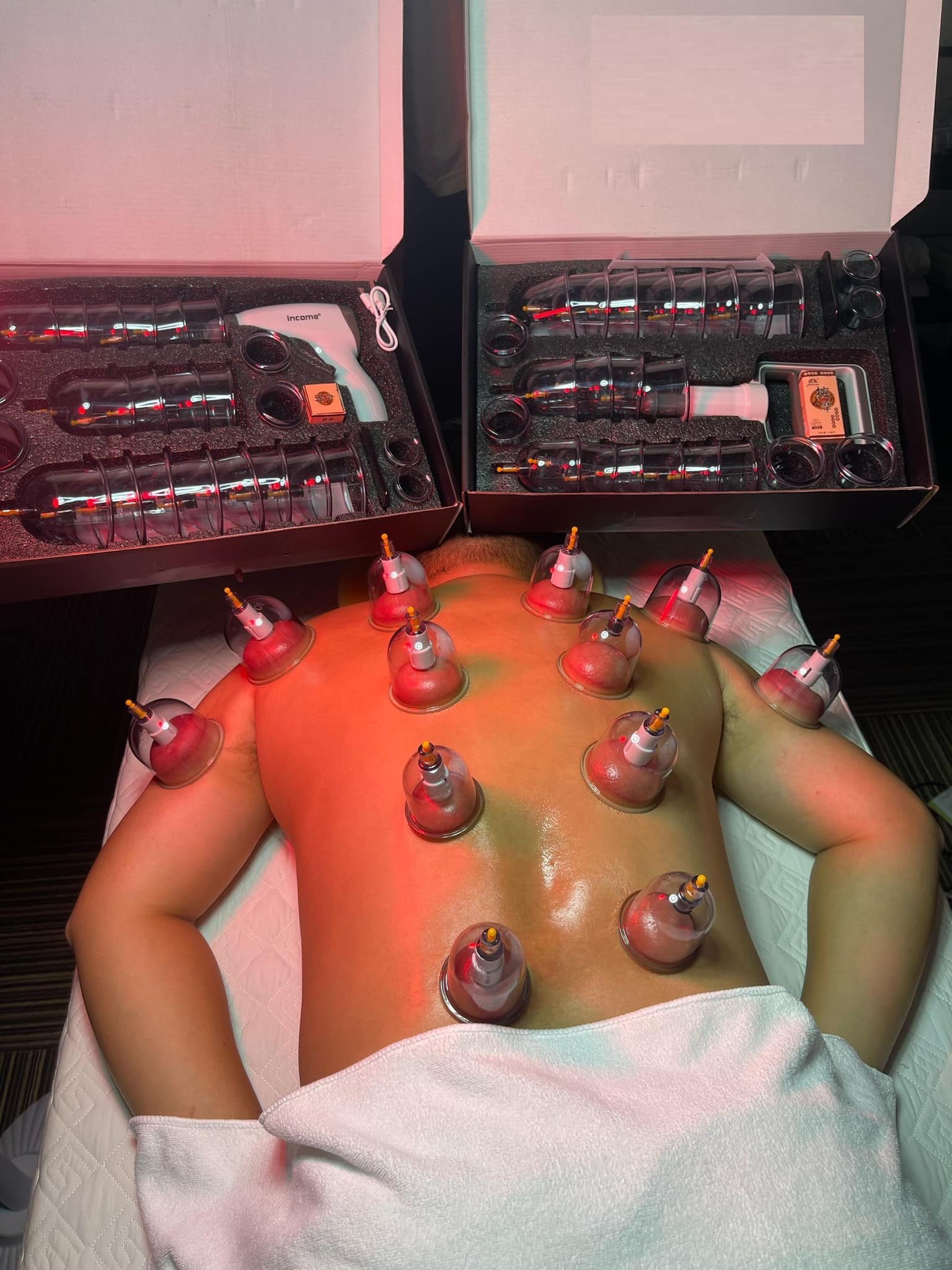 Bộ Giác Hơi Không Dùng Lửa 24 Cốc Massage Chăm Sóc Cơ Thể