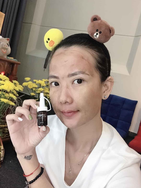 DERMAPEEL TRỨNG CÁ TUYẾT HÀN QUỐC