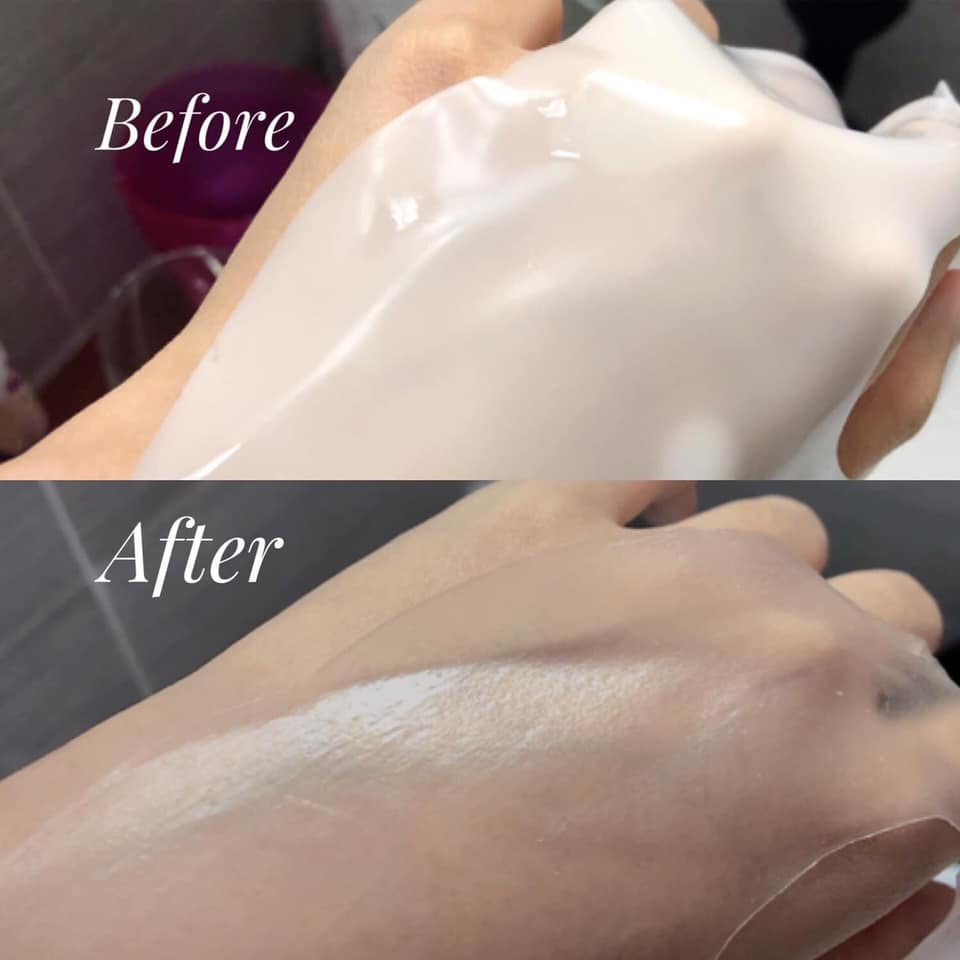 MẶT NẠ THẠCH DERM ALL MATRIX MẪU MỚI