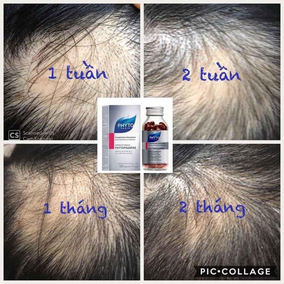 Có Bill - Chống rụng tóc Phyto