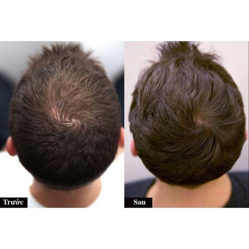 Dầu gội bưởi kích thích mọc tóc, dài tóc, dày tóc HAIR GROWTH 180ml