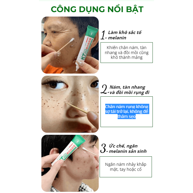Kem chấm nám - tàn nhan KT