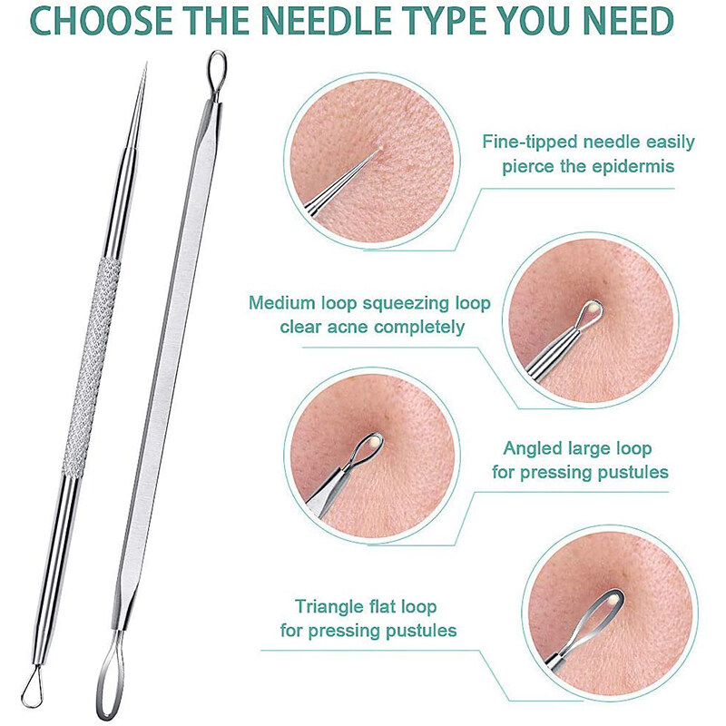 Bộ 5 dụng cụ nặn mụn Có Nhíp