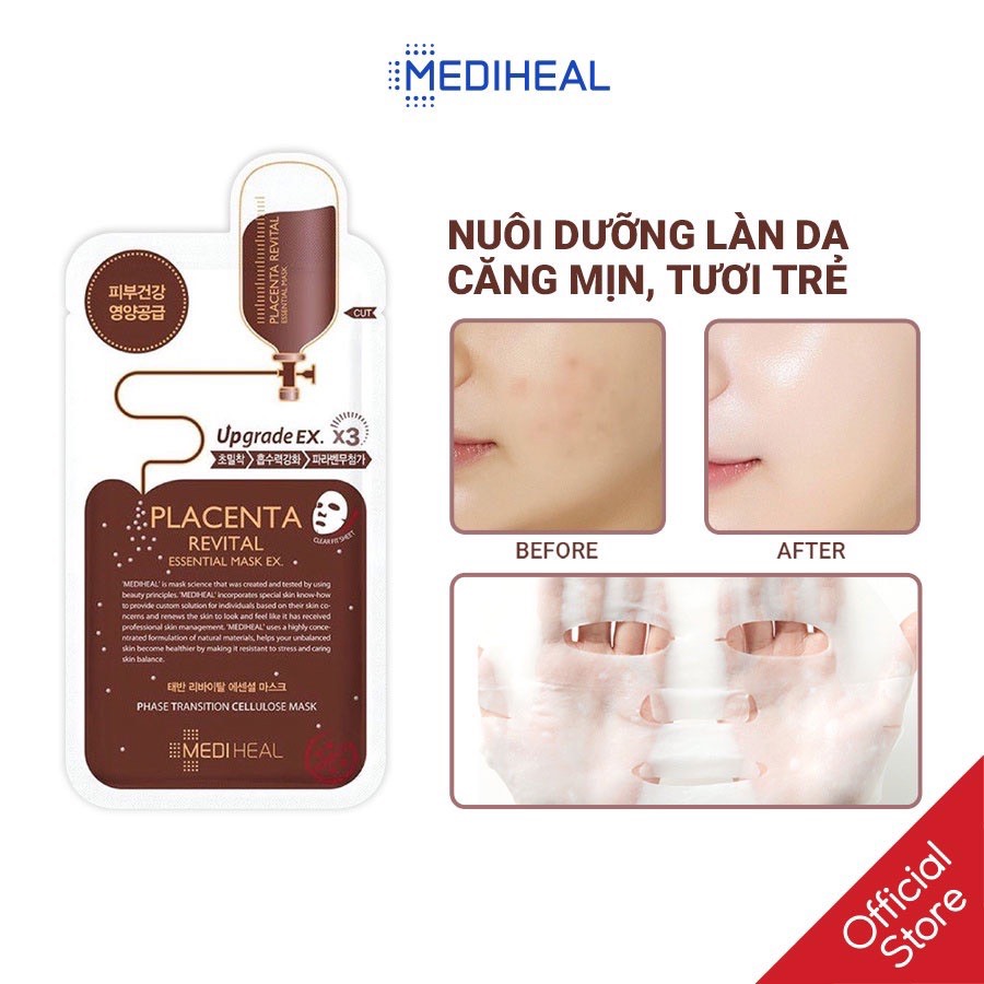 Mặt Nạ Mediheal Essential Mask 25ml