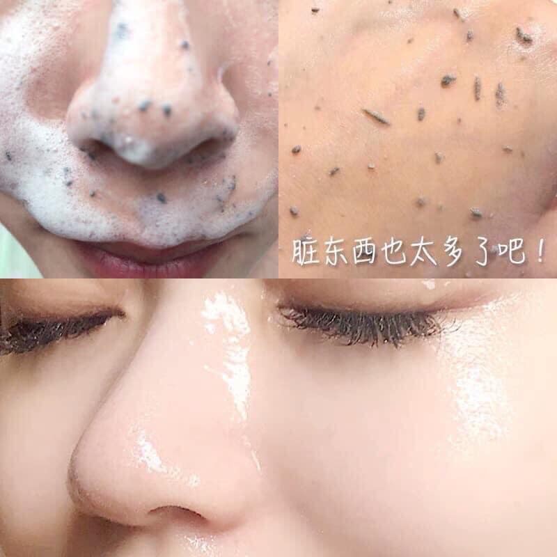 Tẩy da chết dạng bọt NEOGEN Pore Tight Peeling Mousse