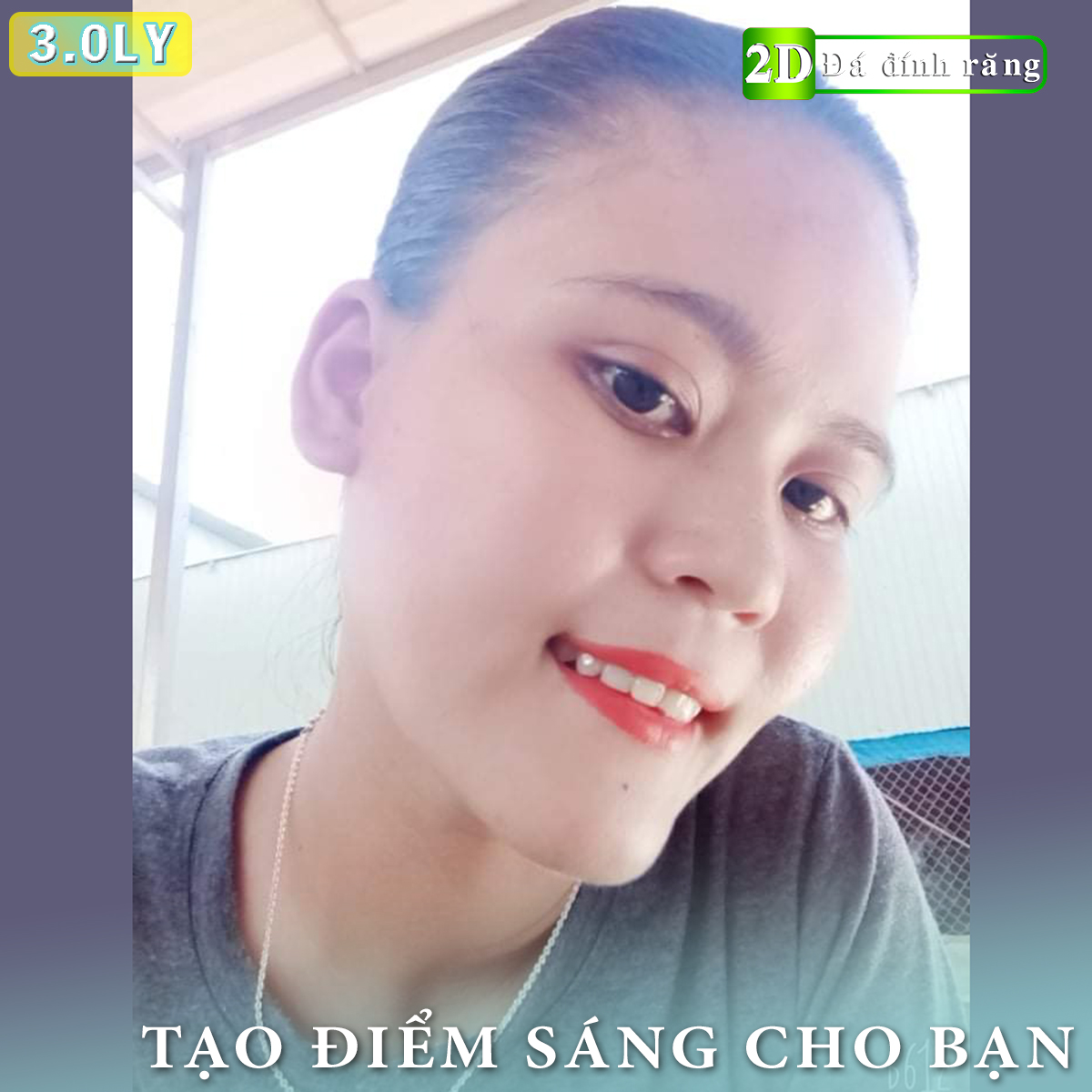 Đá dán răng loại đại cực sáng (5 viên 3LY + keo dán + bút gắn)