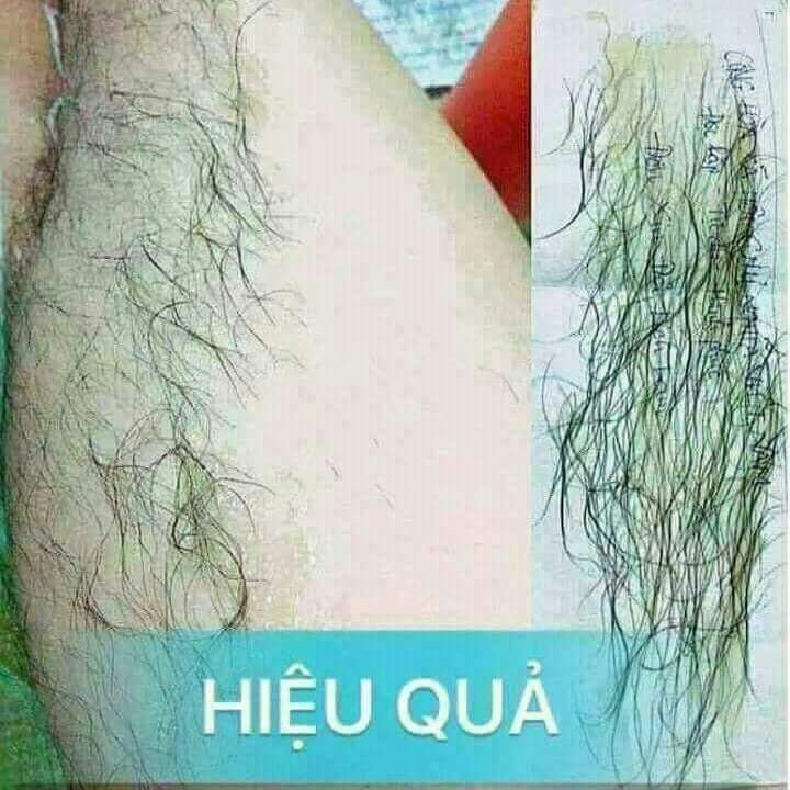 Gói Combo Tẩy Lông An Lành Gồm Wax Lông Và Mỡ Trăn
