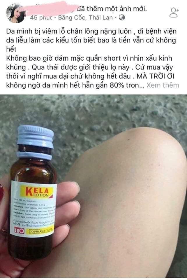 KELA LOTION Bôi Viêm Lỗ Chân Lông Thái Lan