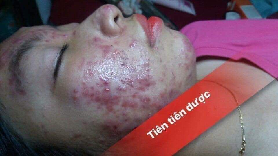 tiên tiên dược