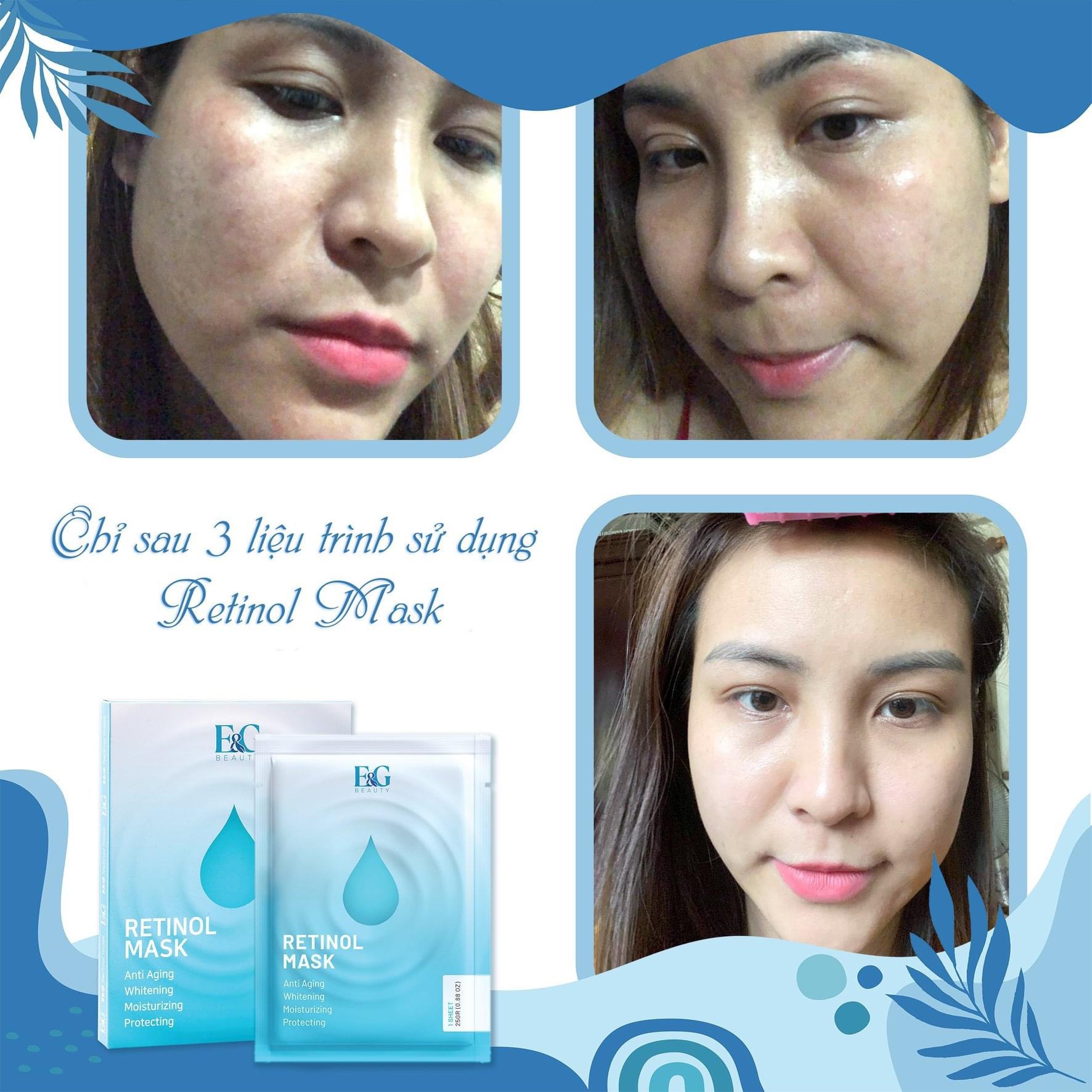 Mặt nạ RETINOL E&G trắng da trẻ hóa làn da