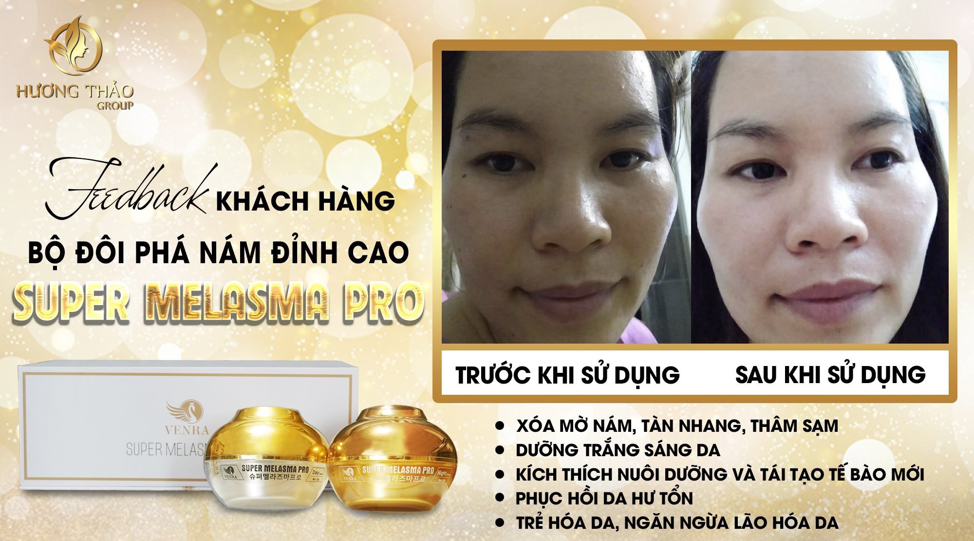 Bộ Đôi Phá Nám Đỉnh Cao Super Melasma Pro