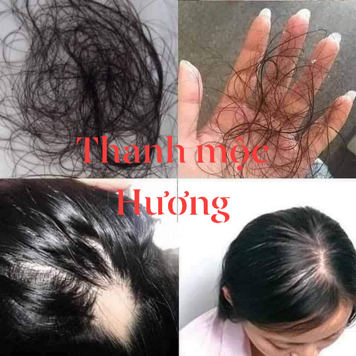 [HCM]Combo Dầu Gội & Dầu Xả Thanh Mộc Hương