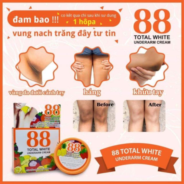 Kem tri. hôi thâm nách làm trắng da vùng nách 88 total white underarm cream 35g