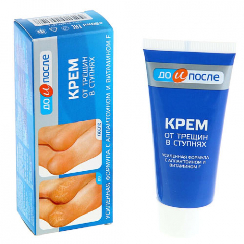 Kem bôi Nứt Gót Chân KPEM"Trước và sau"của Nga Dưỡng Ẩm và Làm Mềm gót chân