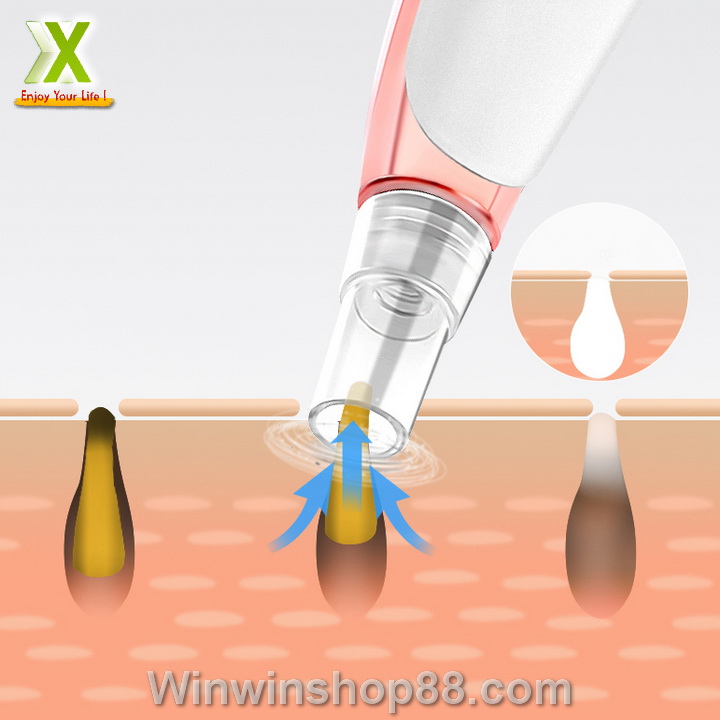 [Hcm]Mini Handheld Blackhead Vacuum Cleaner