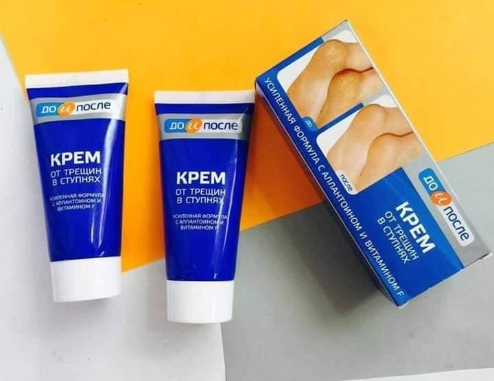 [HCM]Kem Trị Nứt Gót Chân Hàng Nga