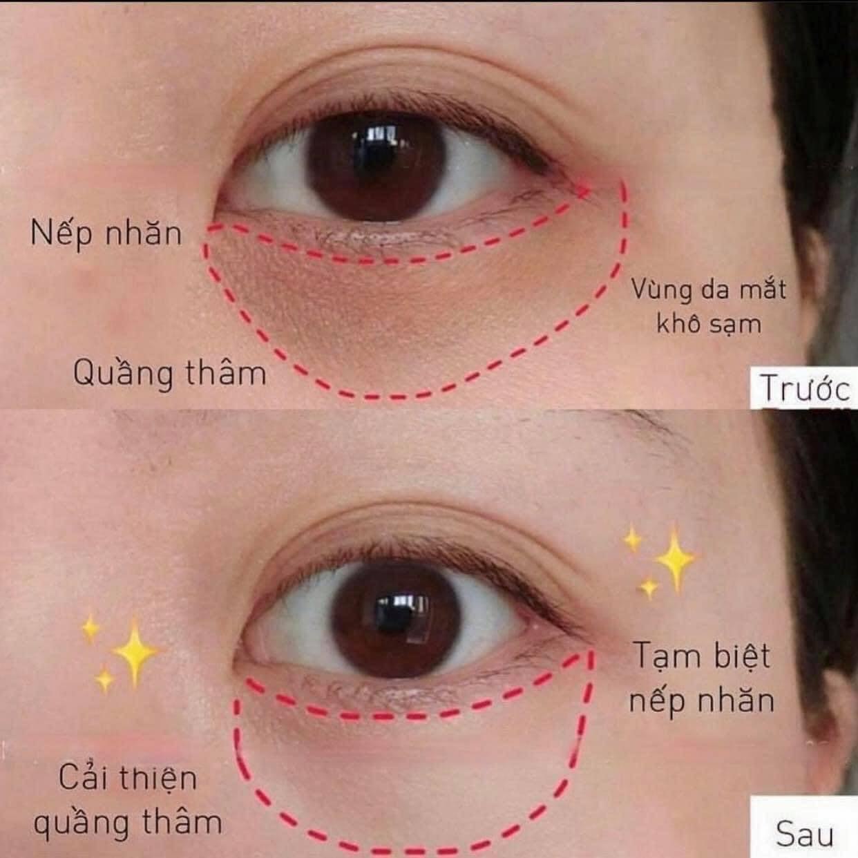 Kem mắt Retinol Eye Cream The Inkey List