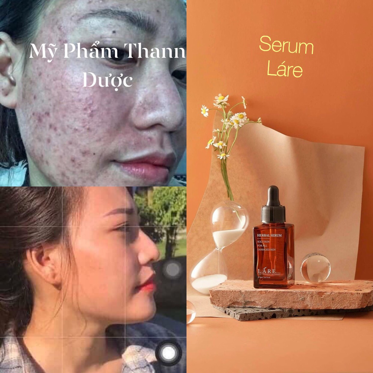 Serum Thanh Dược Lare chiết lẻ 10ml