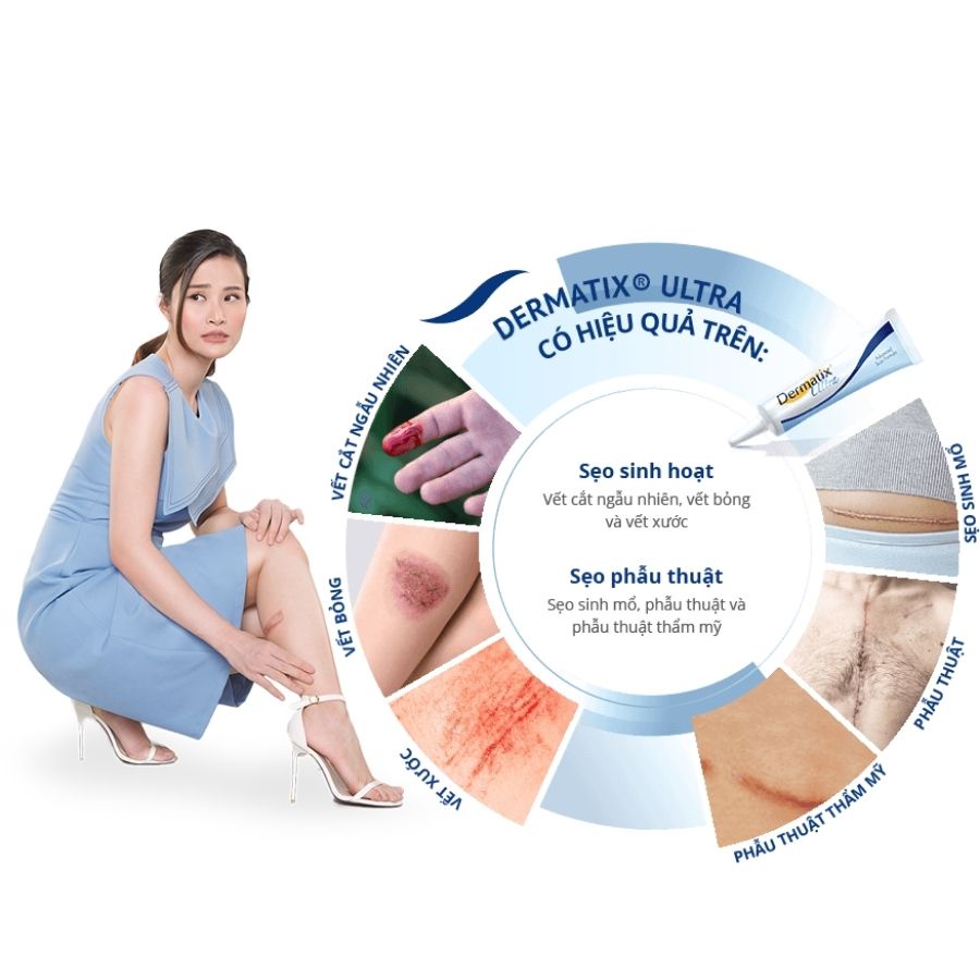 Kem sẹo Dermatix Ultra 15G