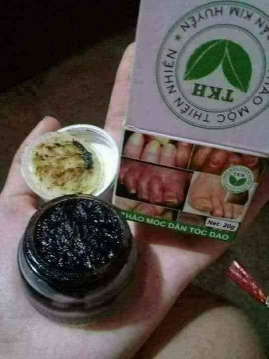 Viêm da,ngoài da Trần Kim Huyền