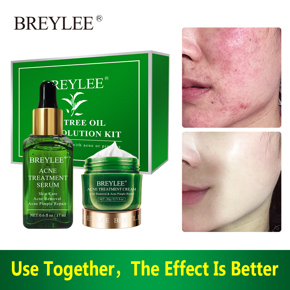 BREYLEE Bộ mỹ phẩm hỗ trợ làm giảm mụn