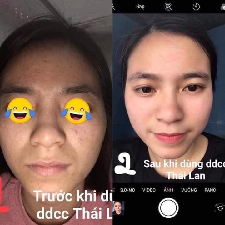 Dưỡng da cao cấp Thái Lan (Full size) Malia - Mẫu mới 2022